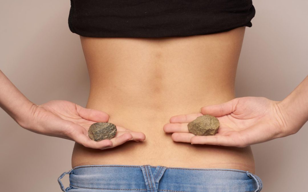 Vesekő kezelése, megelőzése