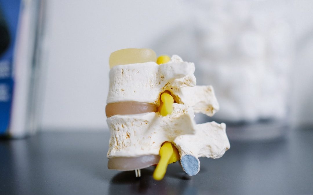 Gerincsérv Kezelése és Megelőzés